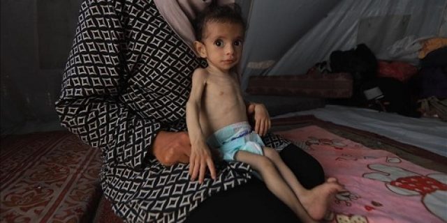 UNICEF: Lebih dari 5.800 anak didiagnosis malnutrisi di Gaza pada bulan Juni