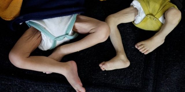 70 persen penduduk Gaza utara diambang kematian