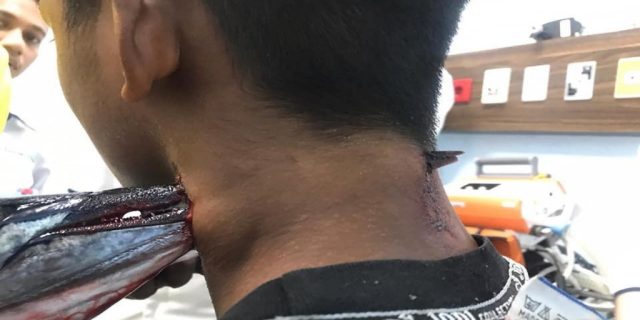 Ikan Ini Bisa Terbang, Saat Mancing Siswa SMP di Makassar Dicocok Lehernya Hingga Tembus