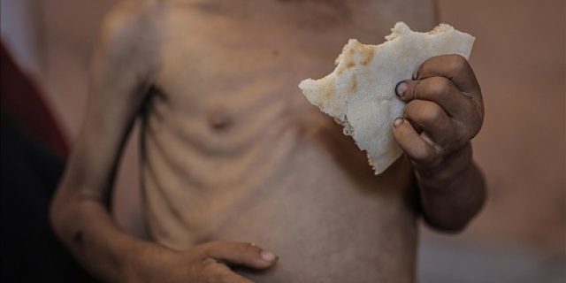 Malnutrisi ‘Rekayasa’: Kepala Badan PBB memperingatkan tentang krisis kelaparan anak yang semakin dalam di Gaza Malnutrisi ‘Rekayasa’: Kepala Badan PBB memperingatkan tentang krisis kelaparan anak yang semakin dalam di Gaza