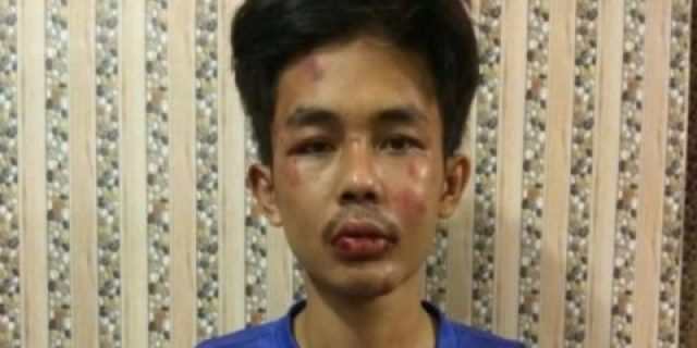 Terkuak, Ini Identitas Pelaku Penusuk Syekh Ali Jaber