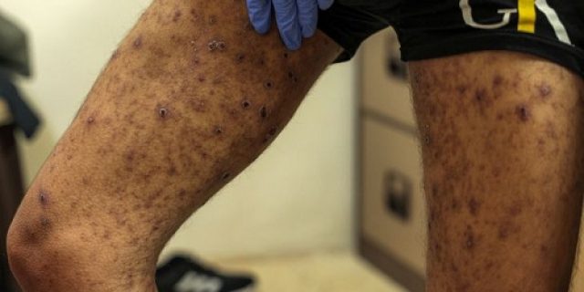 Warga Palestina yang dibebaskan oleh Israel menunjukkan tanda-tanda ‘penyiksaan, kelaparan’