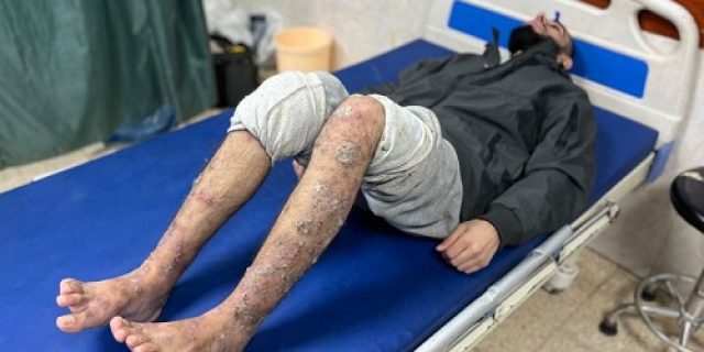 Warga Palestina yang dibebaskan berbagi kisah mengerikan tentang penahanan Israel Warga Palestina yang dibebaskan berbagi kisah mengerikan tentang penahanan Israel