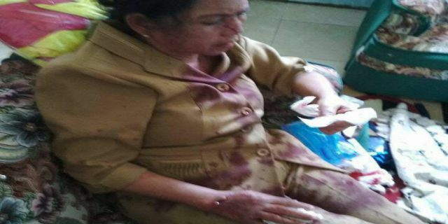 Lagi, guru perempuan babak belur dianiaya oleh wali murid