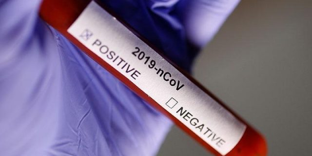 Lembaga Biologi Molekuler Eijkman Berhasil Telusuri Perjalanan Virus Corona di Indonesia