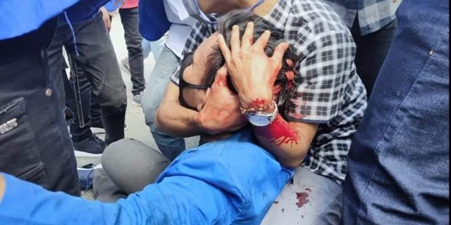 DPRD Jatim Tuding Polisi Anarkis Tidak Profesional Tangani Aksi Demo PMII
